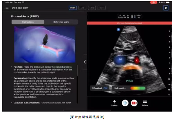 【海外風(fēng)雲(yún)】Butterfly Network 推進(jìn)人工智能在主動脈瓣篩查中的應(yīng)用-江蘇網(wǎng)站制作